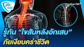 รู้ทันกันได้ : รู้ทัน "ไขสันหลังอักเสบ" ภัยเงียบคร่าชีวิต