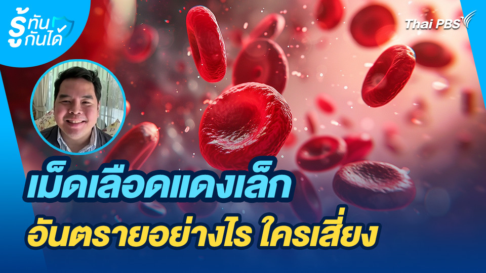 รู้ทันกันได้ : เม็ดเลือดแดงเล็ก อันตรายอย่างไร ใครเสี่ยง