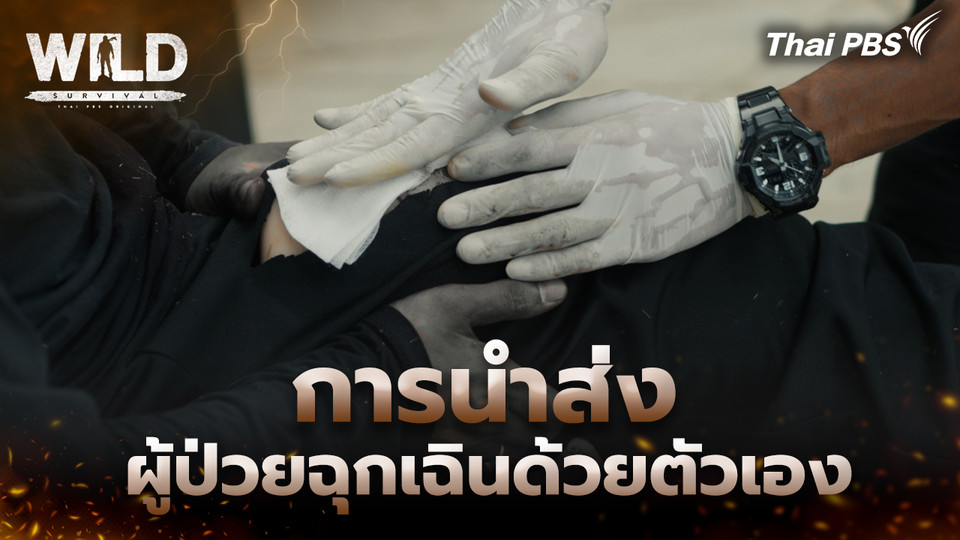 การนำส่งผู้ป่วยฉุกเฉินด้วยตัวเอง