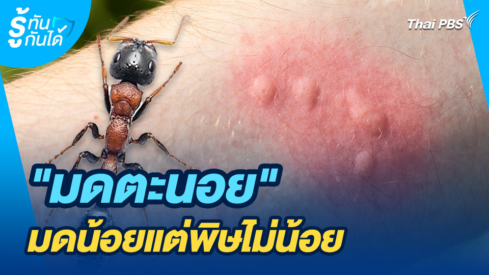 รู้ทันกันได้ : "มดตะนอย" มดน้อยแต่พิษไม่น้อย