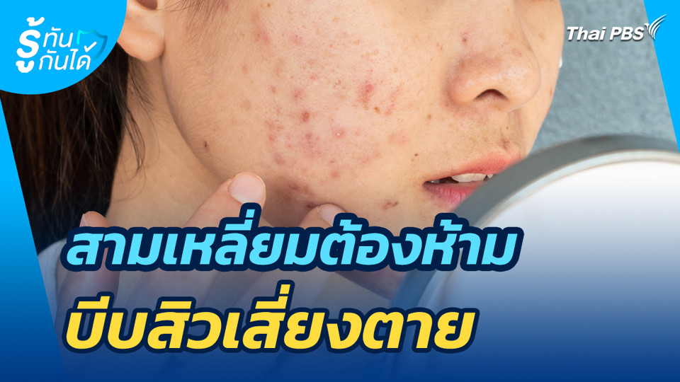 สามเหลี่ยมต้องห้าม บีบสิวเสี่ยงตาย