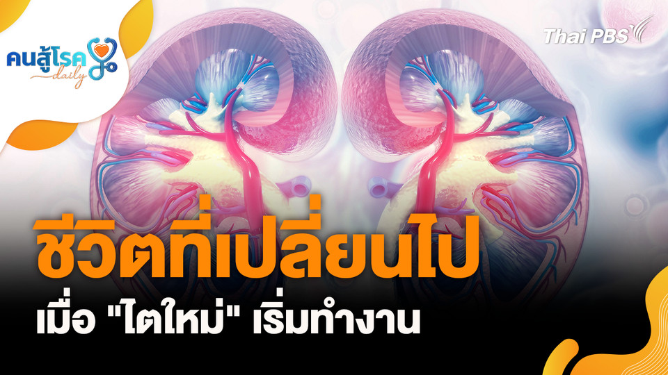 ชีวิตที่เปลี่ยนไป เมื่อ "ไตใหม่" เริ่มทำงาน, "เบอร์เบอรีน" คือยาลดน้ำหนัก ?