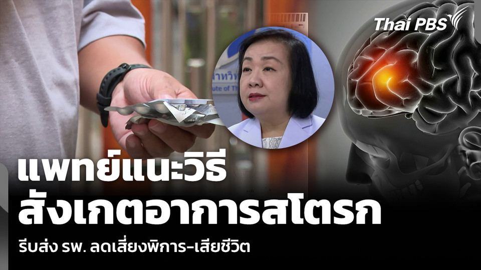แพทย์แนะวิธี สังเกตอาการสโตรก รีบส่ง รพ. ลดเสี่ยงพิการ-เสียชีวิต