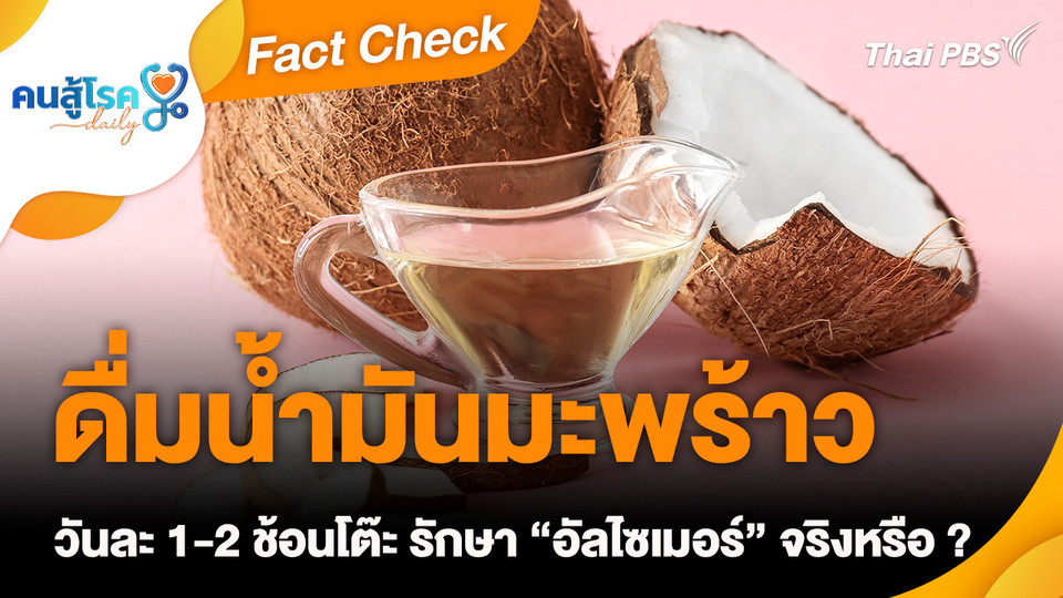 Fact Check : ดื่มน้ำมันมะพร้าว วันละ 1-2 ช้อนโต๊ะ รักษา “อัลไซเมอร์”