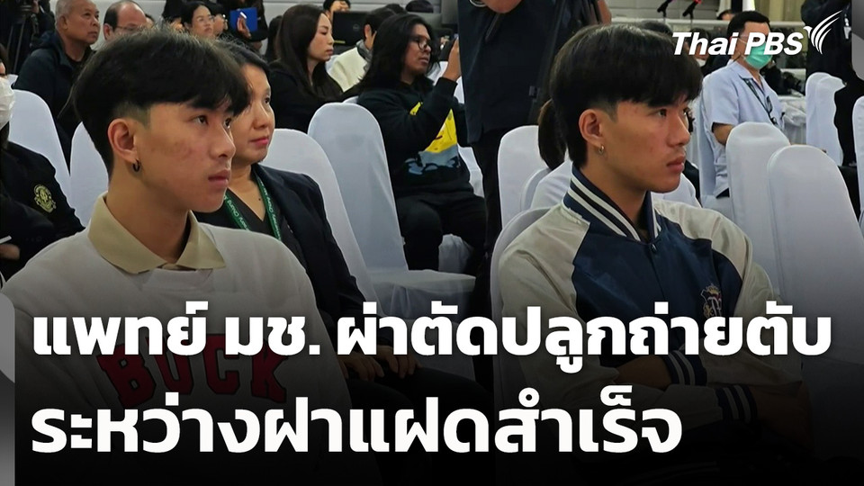 แพทย์ มช. ผ่าตัดปลูกถ่ายตับระหว่างฝาแฝดสำเร็จ