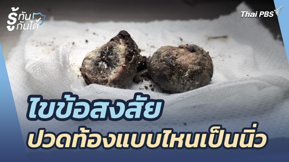 ไขข้อสงสัย ปวดท้องแบบไหนเป็นนิ่ว