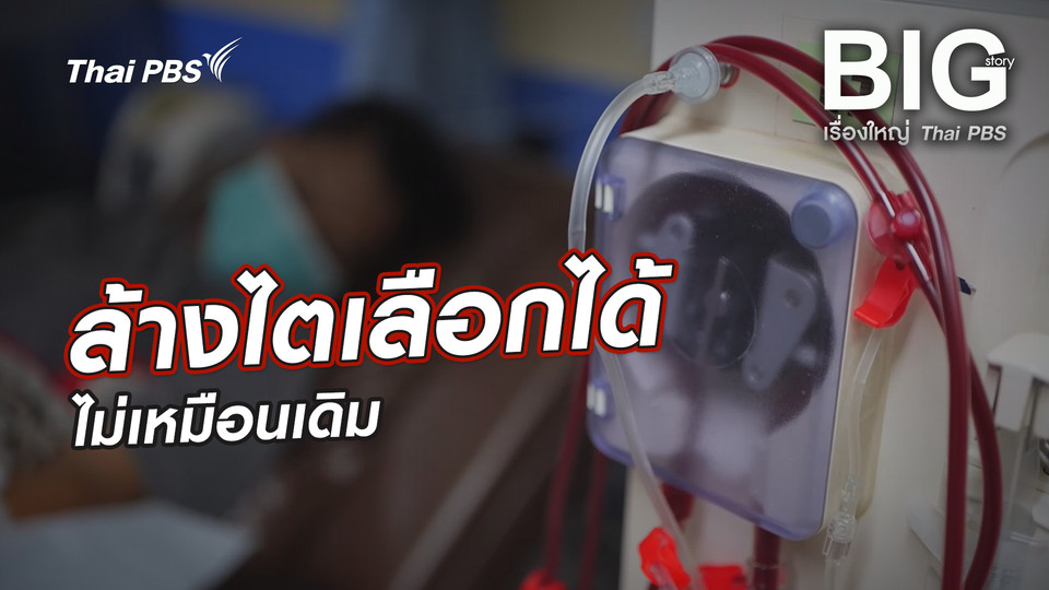 ล้างไตเลือกได้ ใครจ่าย ?