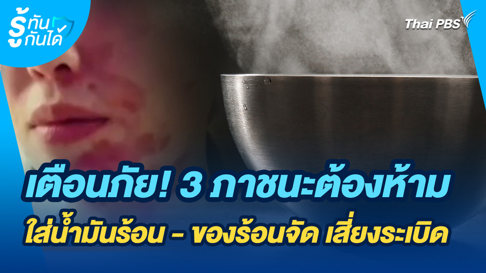 รู้ทันกันได้ : เตือนภัย! 3 ภาชนะต้องห้าม ใส่น้ำมันร้อน - ของร้อนจัด เสี่ยงระเบิด