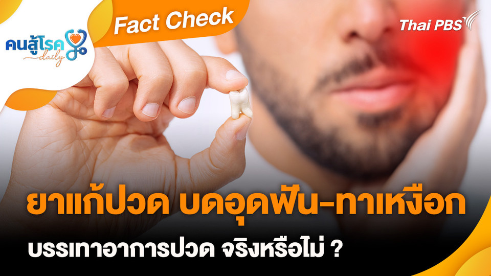 Fact Check : ยาแก้ปวด บดอุดฟัน-ทาเหงือก บรรเทาอาการปวด จริงหรือไม่ ?
