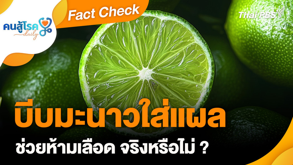 Fact Check : บีบมะนาวใส่แผล ช่วยห้ามเลือด จริงหรือไม่ ?