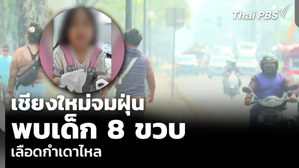 เชียงใหม่จมฝุ่น พบเด็ก 8 ขวบ เลือดกำเดาไหล
