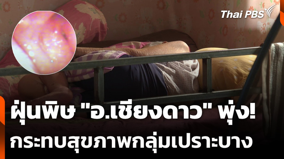 ฝุ่นพิษ "อ.เชียงดาว" พุ่ง! กระทบสุขภาพกลุ่มเปราะบาง
