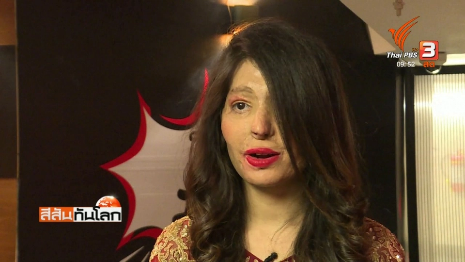 ผู้รอดชีวิตจากการสาดน้ำกรดเดินแบบแฟชั่นโชว์