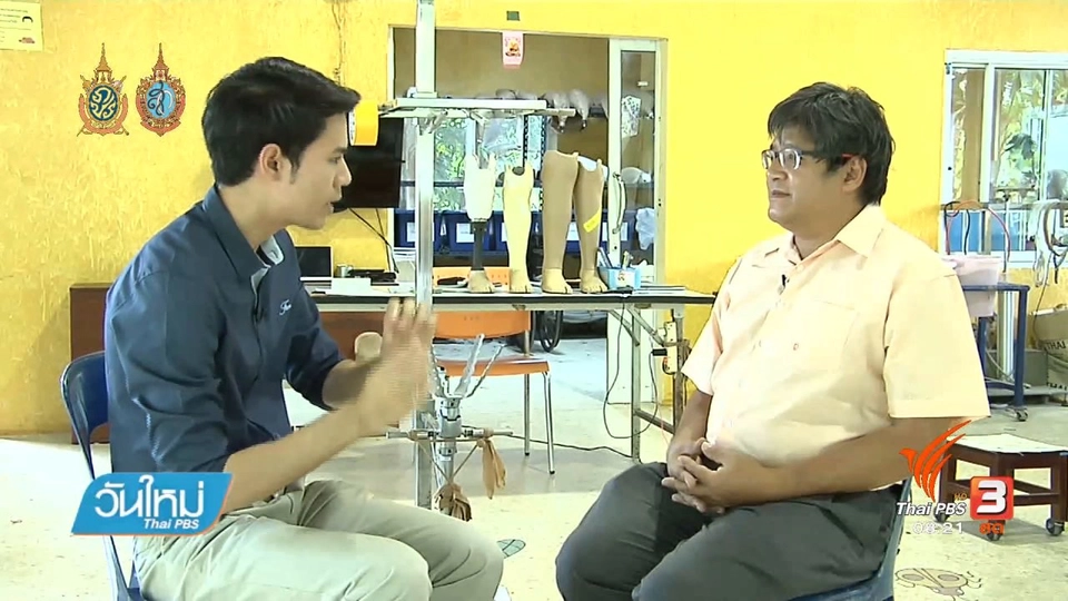 วัดสุอลูมิเนียมนำไปรีไซเคิลทำองค์ประกอบขาเทียม