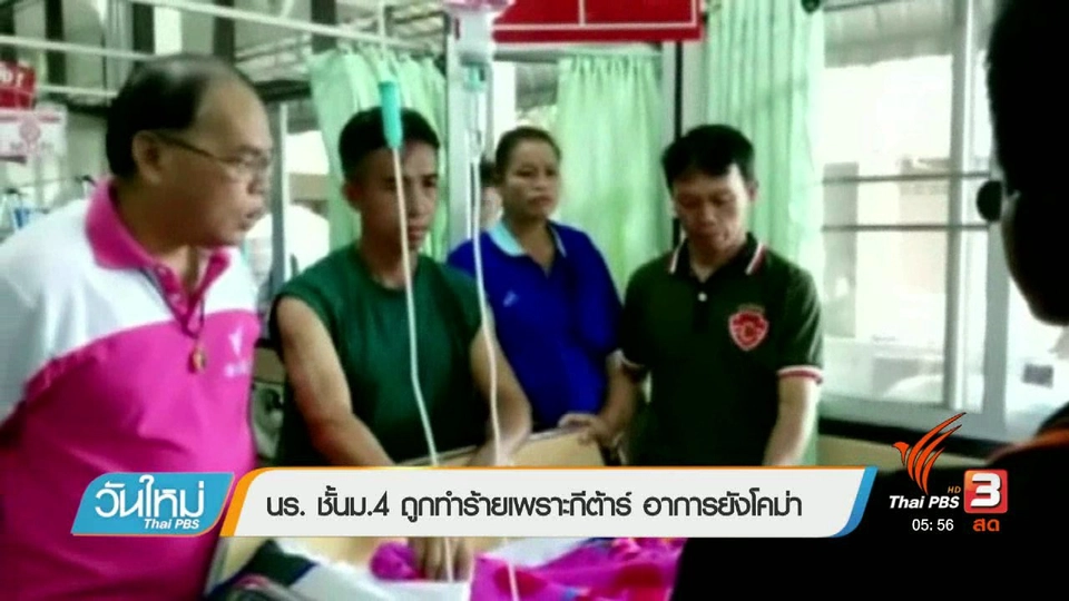 นร. ชั้นม.4 ถูกทำร้ายเพราะกีต้าร์ อาการยังโคม่า