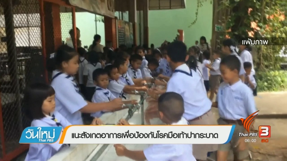 แนะสังเกตอาการเพื่อป้องกันโรคมือเท้าปากระบาด