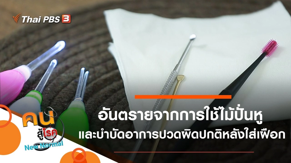 อันตรายจากการใช้ไม้ปั่นหู, บำบัดอาการปวดผิดปกติหลังใส่เฝือก