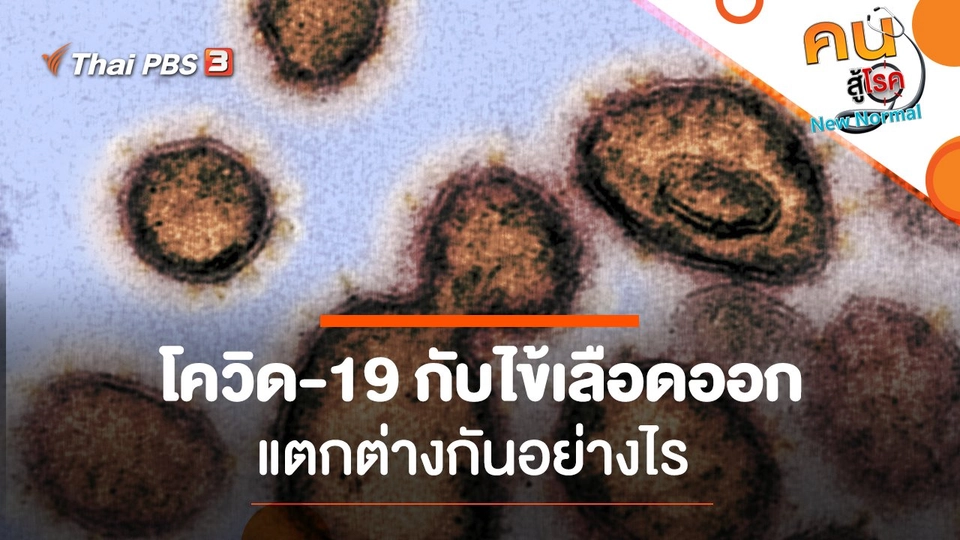 โควิด-19 กับไข้เลือดออก ​แตกต่างกันอย่างไร