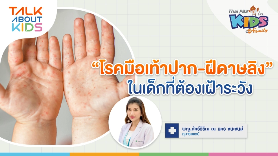 "โรคมือเท้าปาก-ฝีดาษลิง" ในเด็กที่ต้องระวัง