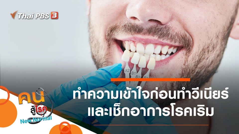 ทำความเข้าใจก่อนทำวีเนียร์, เช็กอาการโรคเริม