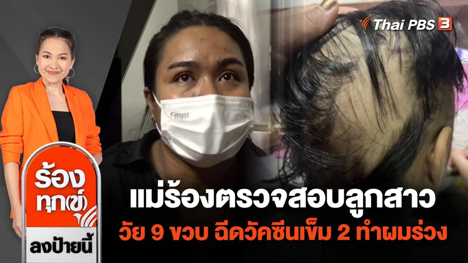 แม่ร้องตรวจสอบ ลูกสาววัย 9 ขวบ ฉีดวัคซีนเข็ม 2 ทำผมร่วง จ.ภูเก็ต