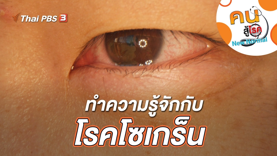 ทำความรู้จักกับโรคโซเกร็น