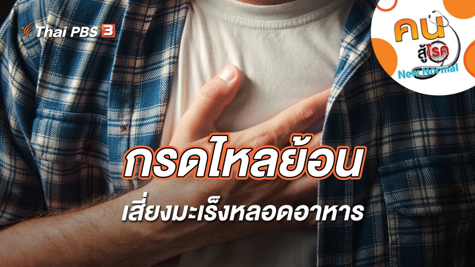 กรดไหลย้อนเสี่ยงมะเร็งหลอดอาหาร