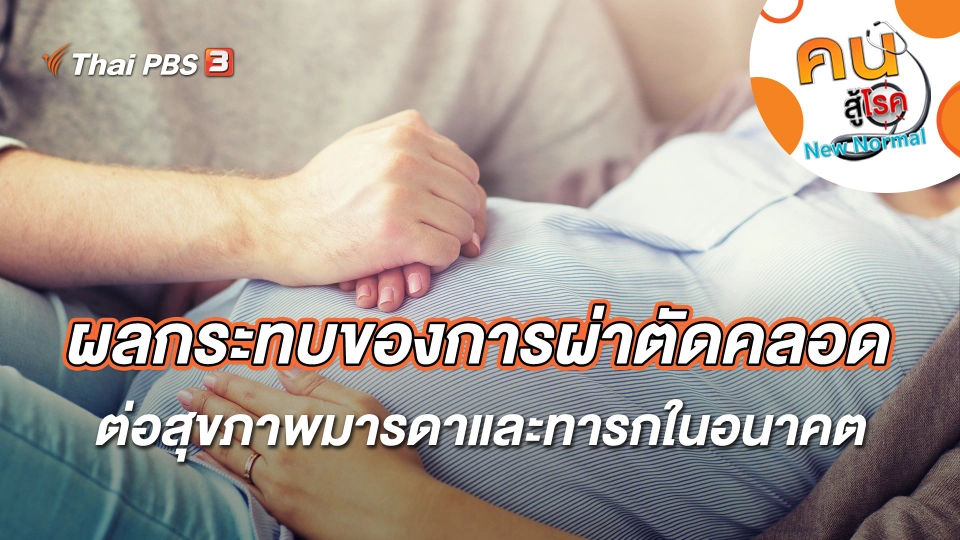 ผลกระทบของการผ่าตัดคลอดต่อสุขภาพมารดาและทารกในอนาคต