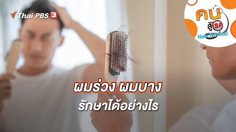 ผมร่วง ผมบาง รักษาได้อย่างไร