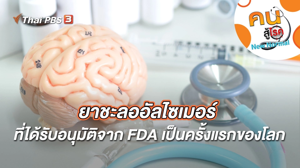 ยาชะลออัลไซเมอร์ที่ได้รับอนุมัติจาก FDA เป็นครั้งแรกของโลก