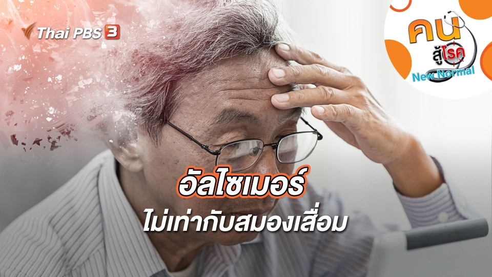 อัลไซเมอร์ไม่เท่ากับสมองเสื่อม