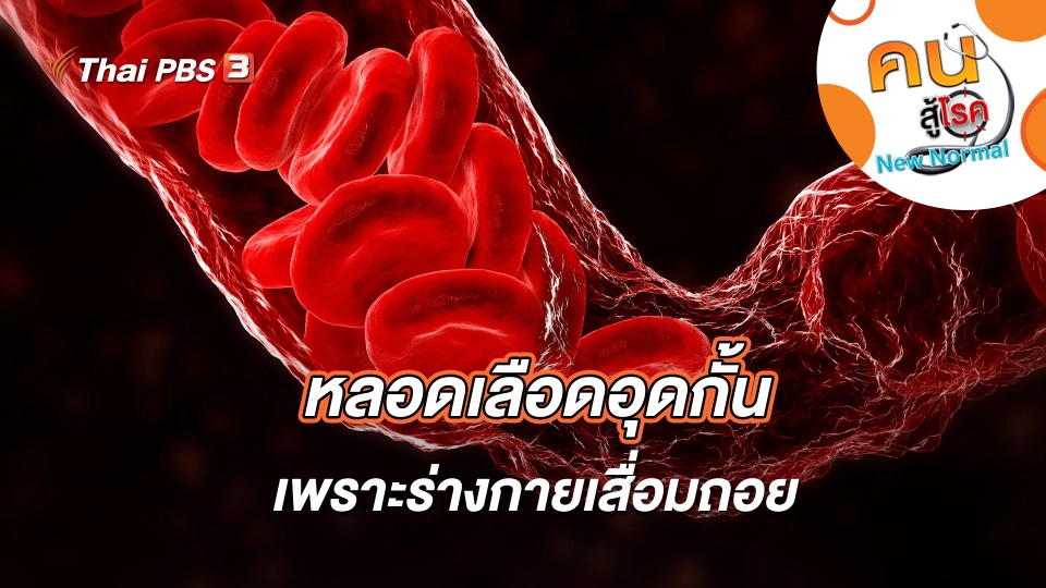 หลอดเลือดอุดกั้นเพราะร่างกายเสื่อมถอย