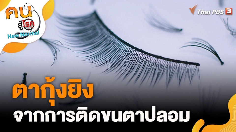 ตากุ้งยิง จากการติดขนตาปลอม