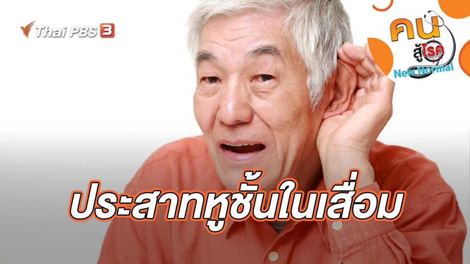 ประสาทหูชั้นในเสื่อม