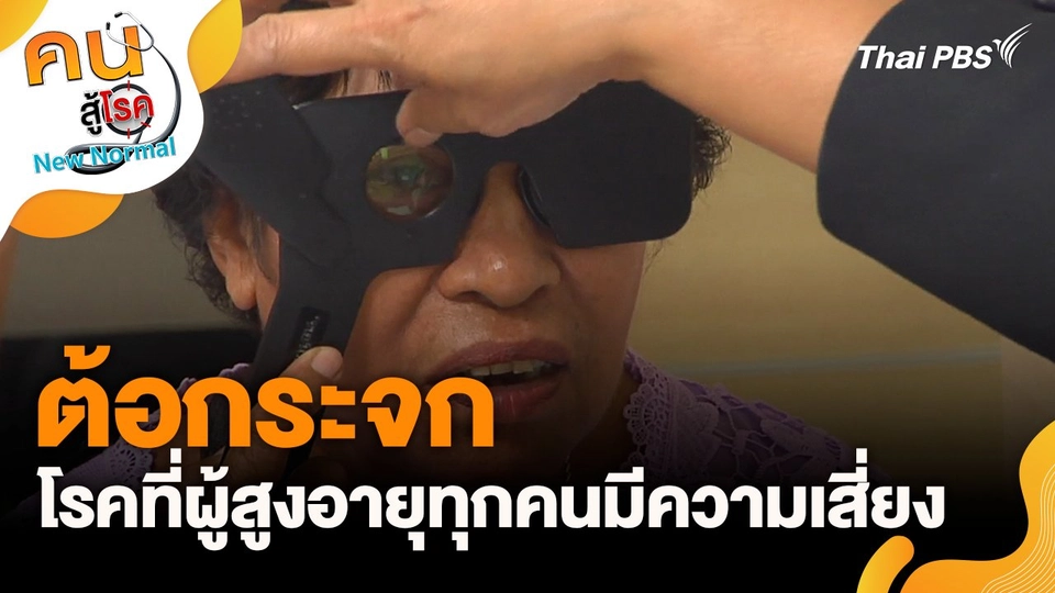 ต้อกระจกโรคที่ผู้สูงอายุทุกคนมีความเสี่ยง