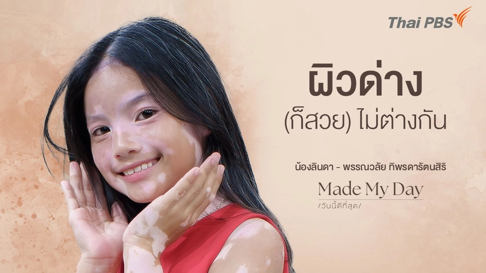 ผิวด่าง (ก็สวย) ไม่ต่างกัน - พรรณวลัย ทิพรดารัตนสิริ