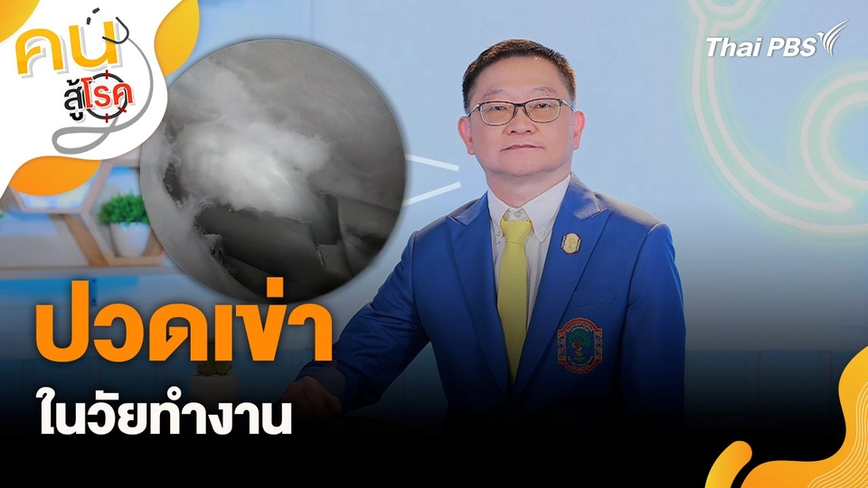 ปวดเข่า ในวัยทำงาน