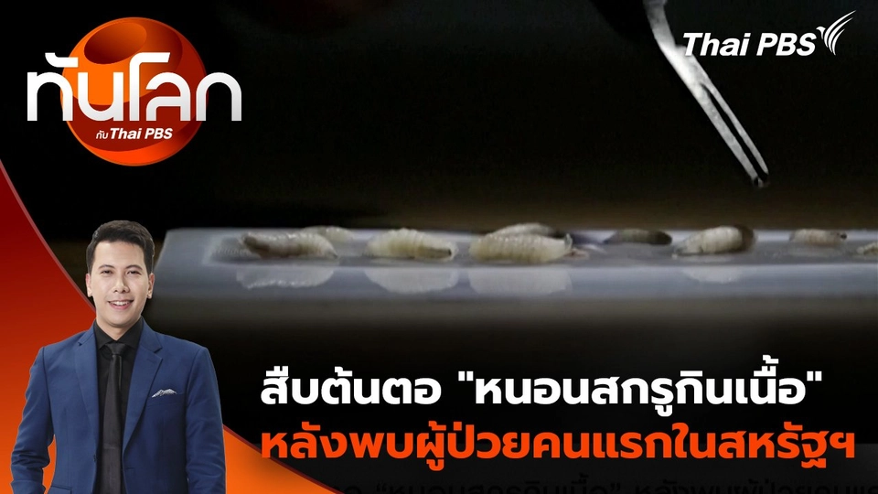สืบต้นตอ “หนอนสกรูกินเนื้อ” หลังพบผู้ป่วยคนแรกในสหรัฐฯ | 26 ส.ค. 68
