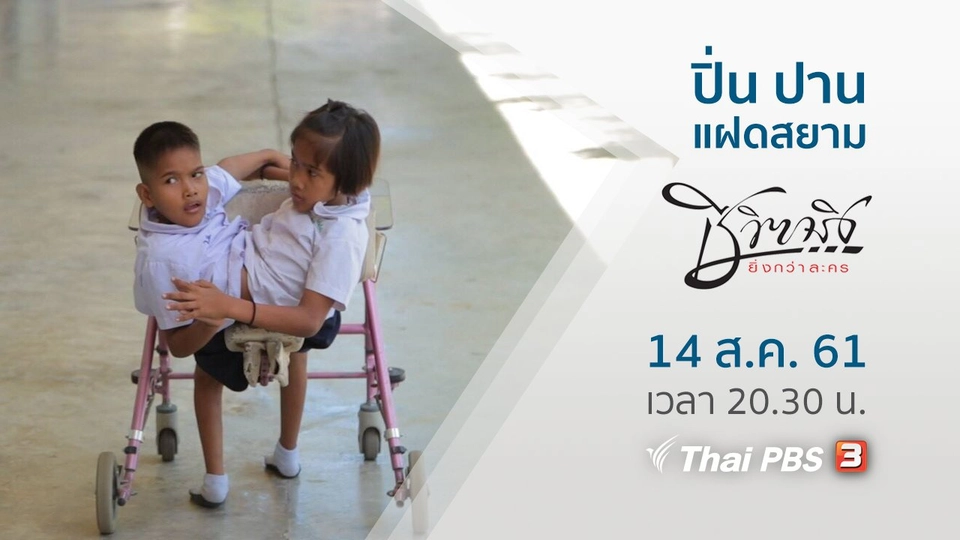 ปิ่น ปาน แฝดสยาม