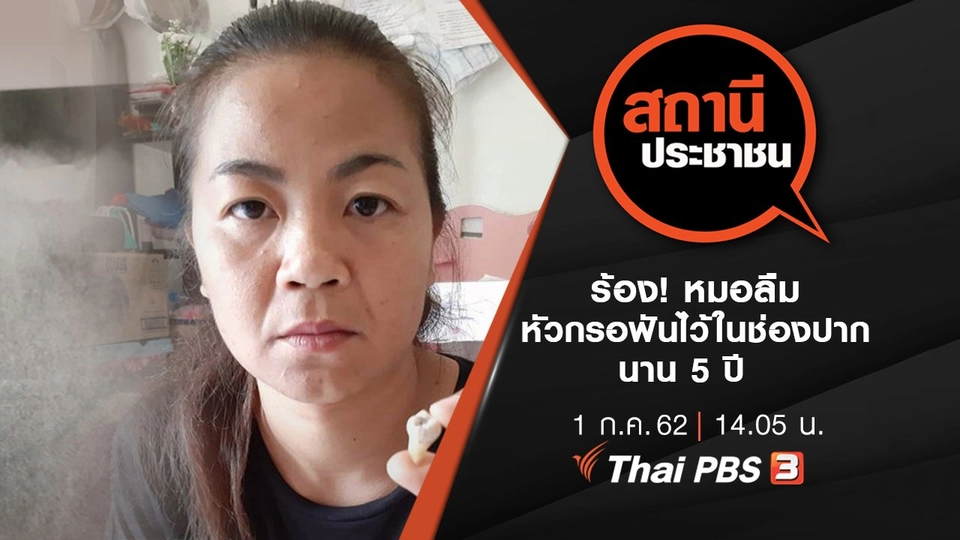 ร้อง! หมอลืมหัวกรอฟันไว้ในช่องปากนาน 5 ปี