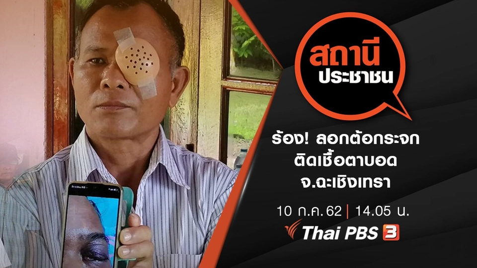 ร้อง! ลอกต้อกระจก ติดเชื้อตาบอด จ.ฉะเชิงเทรา