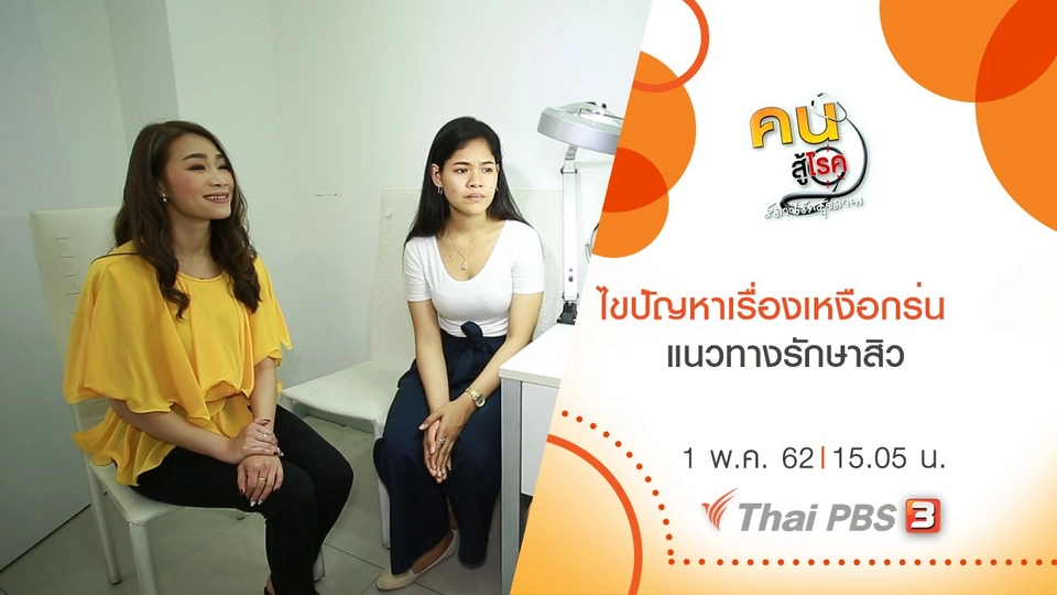 ​ไขปัญหาเรื่องเหงือกร่น, แนวทางรักษาสิว