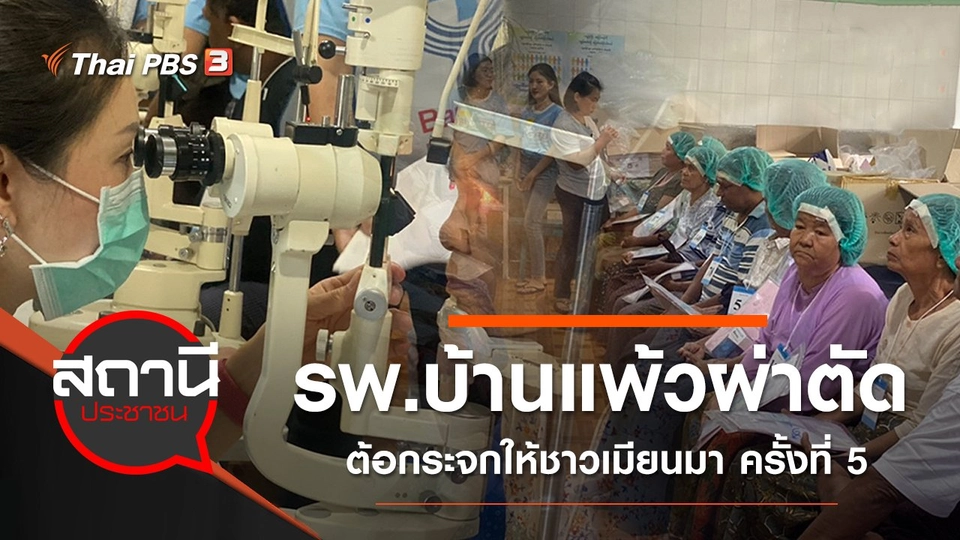 รพ.บ้านแพ้วผ่าตัดต้อกระจกให้ชาวเมียนมา ครั้งที่ 5