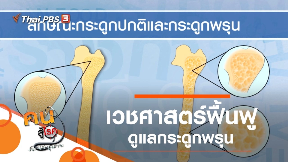 เวชศาสตร์ฟื้นฟู ดูแลกระดูกพรุน, บริหารง่าย ๆ ทำเองได้ แก้ปวดหลังในระยะยาว