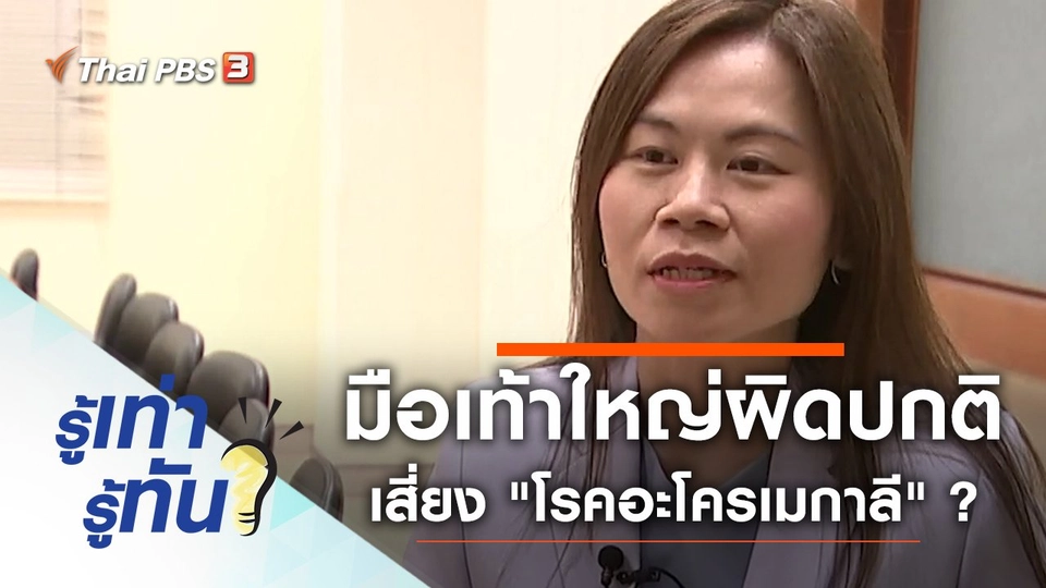 มือเท้าใหญ่ผิดปกติ เสี่ยง "โรคอะโครเมกาลี" ?