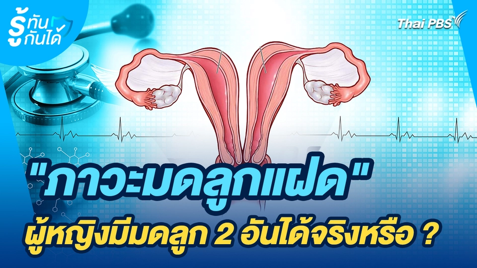 รู้ทันกันได้ : "ภาวะมดลูกแฝด" ผู้หญิงมีมดลูก 2 อันได้จริงหรือ?