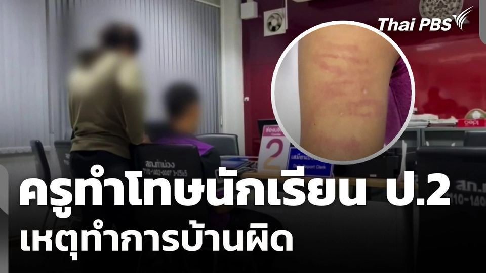 ผู้ปกครองแจ้งความ ครูทำโทษนักเรียน ป.2 เหตุทำการบ้านผิด