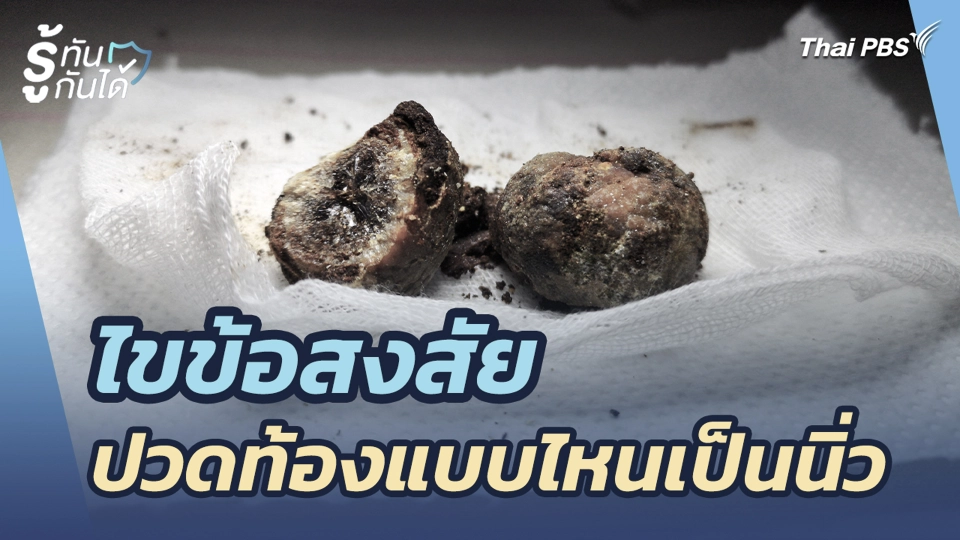 ไขข้อสงสัย ปวดท้องแบบไหนเป็นนิ่ว