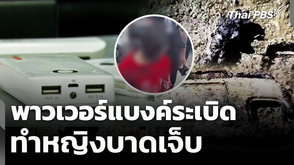 พาวเวอร์แบงค์ระเบิดทำหญิงบาดเจ็บ 