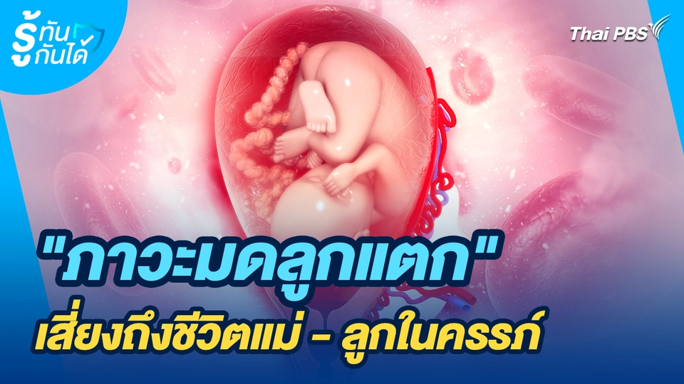 รู้ทันกันได้ : "ภาวะมดลูกแตก" เสี่ยงถึงชีวิตแม่ - ลูกในครรภ์